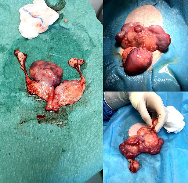 File:HighcroftVetGroupTumours1.jpg