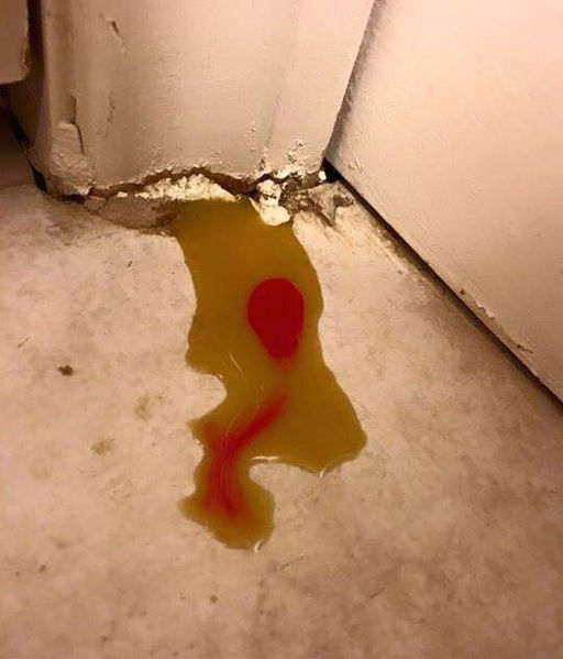 File:BoldInUrine1a.jpg